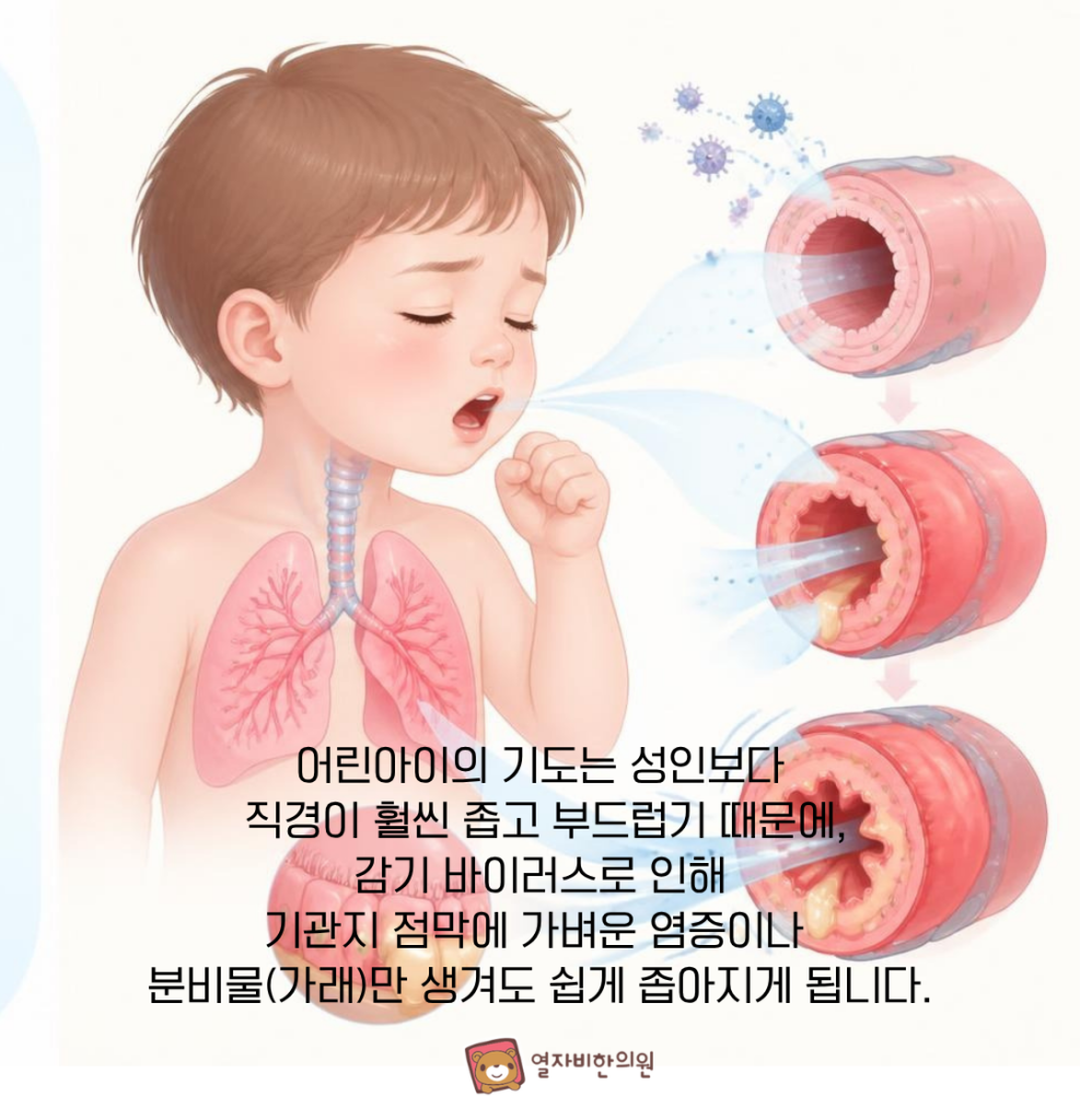 기관지염 반복이유